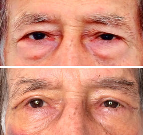 Caneta Lifting Instantânea - Trend+